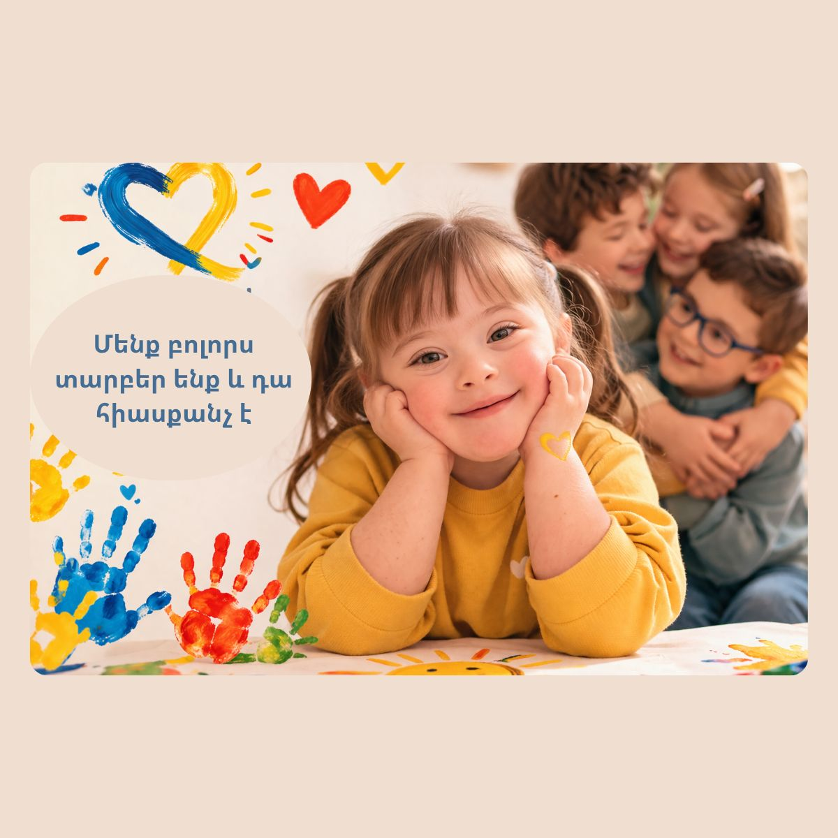 21 de marzo – Día Mundial del Síndrome de Down